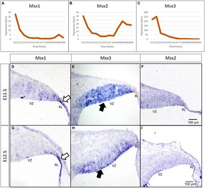 Msx genes delineate a novel molecular map of the developing cerebellar neuroepithelium